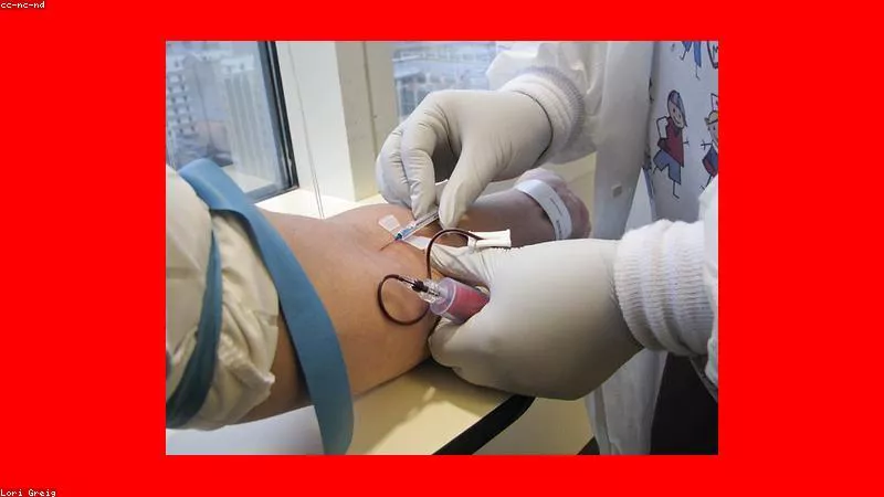Chế độ ăn nhạt và ích lợi bảo vệ tim mạch ngừa đột quỵ